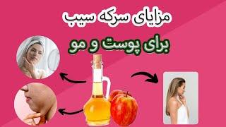 فواید سرکه سیب برای پوست و مو | خواص سرکه سیب برای لاغری