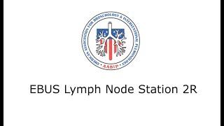 EBUS Lymph Node Station 2R