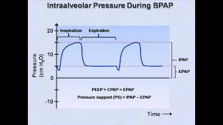 Non-Invasive Positive Pressure Ventilation (Mechanical Ventilation - Lecture 6)