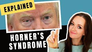 Horners Syndrome with the help of Donald Trump (High definition)