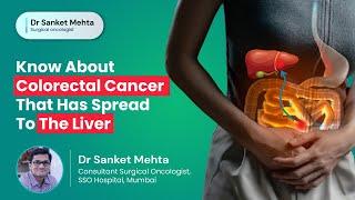 Know About Colorectal Cancer That Has Spread to the Liver | Colorectal Liver Metastasis | Dr. Sanket