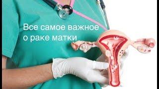 Рак матки: можно ли вылечиться? Сколько стоит лечение и какой прогноз при раке матки?