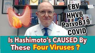 Is Hashimoto’s CAUSED by These 4 Viruses? EBV, Herpes, COVID, Parvo - Testing, Treatment, A Warning