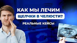 Щелчки в челюсти при открывании рта. Как лечат? Разбор случаев из практики