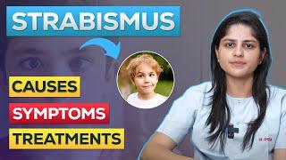 What is Strabismus or Squint Eye ? | How To Fix Strabismus Eyes