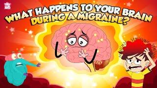 What Is a Migraine Headache? | What Happens to Your Brain During a Migraine? | The Dr Binocs Show