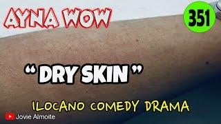 DRY SKIN | AYNA WOW 351 | ILOCANO COMEDY DRAMA | Jovie Almoite