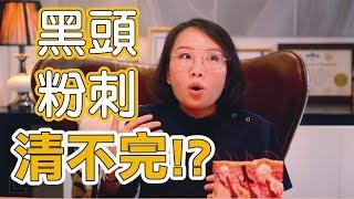 黑頭粉刺清都清不完，我該如何有效清粉刺？粉刺我到底該不該清？