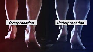 How to Determine your Pronation