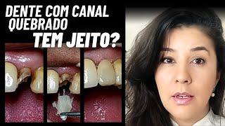 Dente com canal quebrou um pedaço/ Tem jeito de consertar?