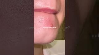 ХОЧЕШЬ ЗДОРОВУЮ КОЖУ? 139625239 РП 🫶 #уходзакожей