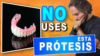 Prótesis 𝗛𝗜𝗕𝗥𝗜𝗗𝗔𝗦 𝘀𝗼𝗯𝗿𝗲 𝗜𝗠𝗣𝗟𝗔𝗡𝗧𝗘𝗦 Ventajas y Desventajas.Prótesis Dental Fija que  RECOMIENDO ️