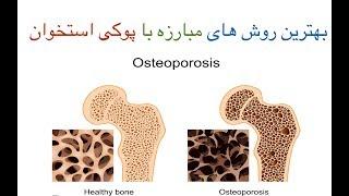 بهترین مواد غذایی برای جلوگیری از پوکی استخوان