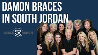 Damon Braces In South Jordan