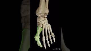 Hallux Valgus (bunion) !!! انحراف شست پا یا بونیون