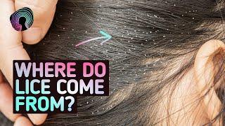 Your Body On Lice (Warning: Distressing Footage)