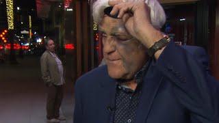 Jay Leno Gets Swollen Eye After Falling Down 60-Foot Hill