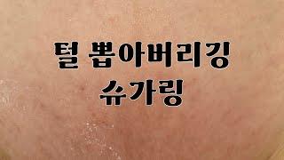 브라질리언 삼각존 털뽑기 | 슈가링 방법 | 슈가링 브라질리언