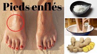 Remèdes maison pour les pieds gonflés - Sante Naturelle