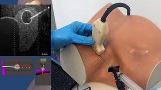 Mixed-Reality Simulator for Ultrasound-Guided Thyroid Biopsy - CSSALT