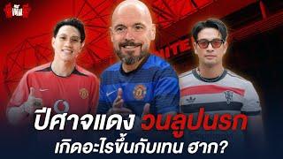 เทน ฮาก อาการเป็นยังไง ? ซอ-เกรทมาเล่าให้ฟัง