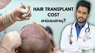 REAL breakdown of COST of Hair Transplant | graft count,medicines, blood tests etc.,