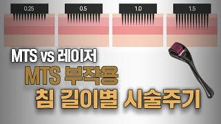 MTS 침길이별 효과 or 부작용 | MTS 전문채널 NO.1 MTS전도사