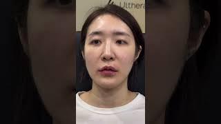 Lip Filler at Girin Plastic Surgery Korea