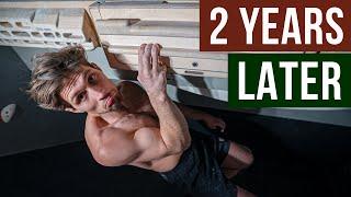 Hangboard Training 2 times per day for 2 years