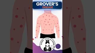 Grover’s Disease - A nutshell #shorts #nurses #students #medicine