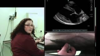 IMV imaging cardiac ultrasound video 9 - Overview of standard right-sided views