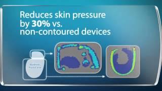 Medtronic PhysioCurve™ CRT-D Design-Hear from the Scientists (for physicians)