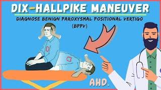 How To Dix-Hallpike Maneuver - Diagnose BPPV - A Doctor Explains