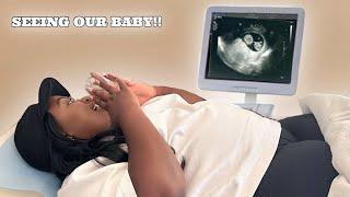 OUR FIRST ULTRASOUND…