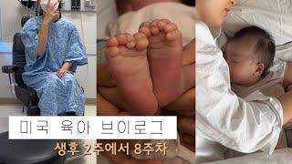 [미국 일상] 엄마랑 산후조리. 수면교육. 설소대 단축증. 모유수유 상담. 유선염. 똑게육아. 혼합수유. Nanit Baby Monitor. Nestig.