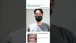 치석은 왜 자주 생길까요? #치과 #치과상식