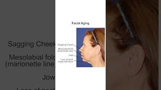 Causes of Facial Volume Loss, or Volume Deficit #facialrejuvenation