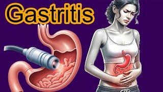 5 Early signs of Gastritis.  Gastritis diagnosis and treatment