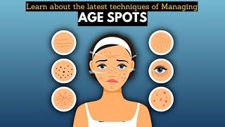 Learn About the Latest Techniques for Managing Age Spots