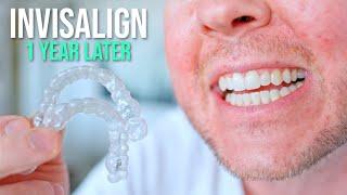 10 Things I Wish I Knew BEFORE Getting Invisalign!