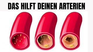 Reinige deine Arterien mit nur 3 Zutaten