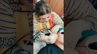 needling