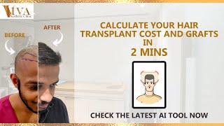 Hair Transplant Graft Calculator | Hair transplant Cost in Mumbai | Viva Aesthetic Clinic