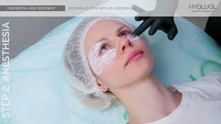 Periorbital Area treatment Xela Rederm 1 1% en 2019