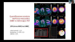 VALUTAZIONE NON INVASIVA DEL MICROCIRCOLO CORONARICO