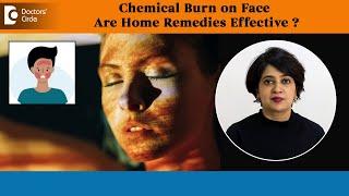 CHEMICAL BURN on Face -Are Home Remedies Effective?| Skin Care Tips-Dr.Rasya Dixit | Doctors' Circle