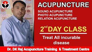 Automatic | Photo | Sound | Depression | Relation  Acupuncture Dr.DK Raj | @dkrajeacupuncture