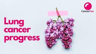 Lung cancer progression video | How lung cancer progresses ? #CancerFax