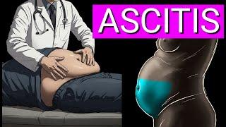 Top 5 Causes of Ascites: What Your Swollen Abdomen Could Be Telling You