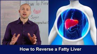 How to Reverse a Fatty Liver | Untold Secrets